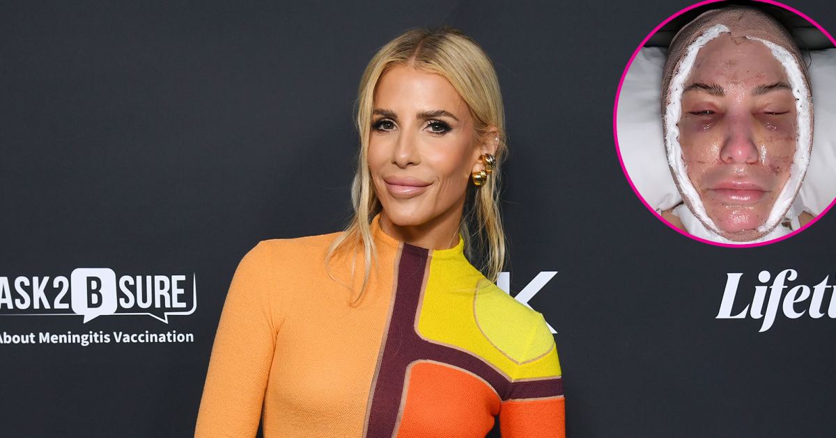 Million Dollar Listing’s Tracy Tutor Shares Selfie After Neck and Facelift Million Dollar Listing’s Tracy Tutor Shares Selfie After Neck and Facelift